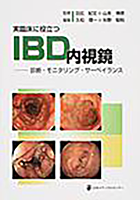 実臨床に役立つIBD内視鏡－診断・モニタリング・サーベイランス