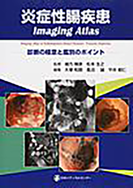 炎症性腸疾患Imaging Atlas－診断の極意と鑑別のポイント