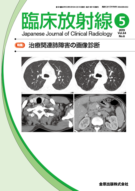 臨床放射線 2019年5月号 64巻6号 特集 治療関連肺障害の画像診断【電子版】