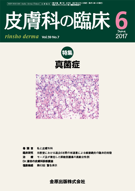 皮膚科の臨床 2017年6月号 59巻7号 特集 真菌症【電子版】