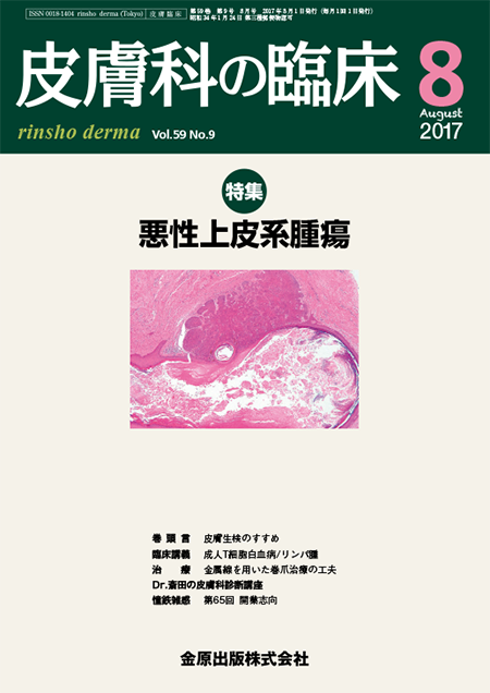 皮膚科の臨床 2017年8月号 59巻9号 特集 悪性上皮系腫瘍【電子版】