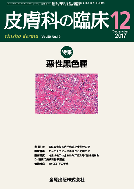 皮膚科の臨床 2017年12月号 59巻13号 特集　悪性黒色腫【電子版】