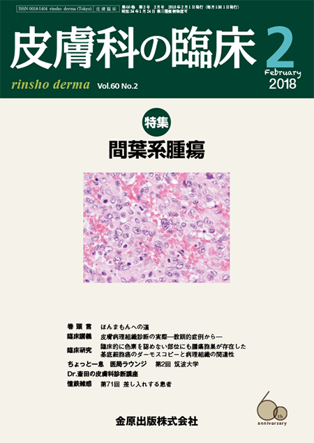 皮膚科の臨床 2018年2月号 60巻2号 特集　間葉系腫瘍【電子版】