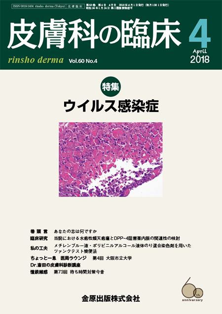 皮膚科の臨床 2018年4月号 60巻4号 特集　ウイルス感染症【電子版】