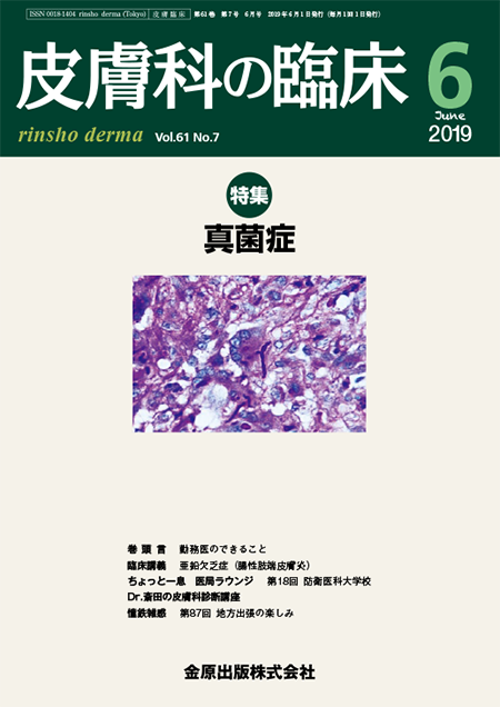 皮膚科の臨床 2019年6月号 61巻7号 特集 真菌症【電子版】