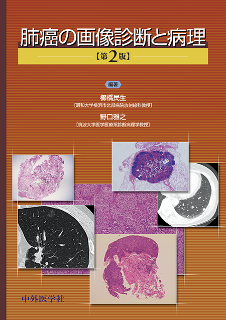 肺癌の画像診断と病理[改訂2版]