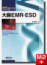 症例で身につける消化器内視鏡シリーズ　大腸EMR・ESD