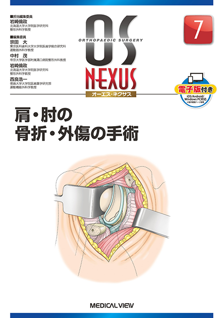 OS NEXUS7 肩・肘の骨折・外傷の手術