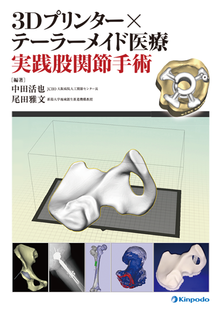 3Dプリンター×テーラーメイド医療 実践股関節手術