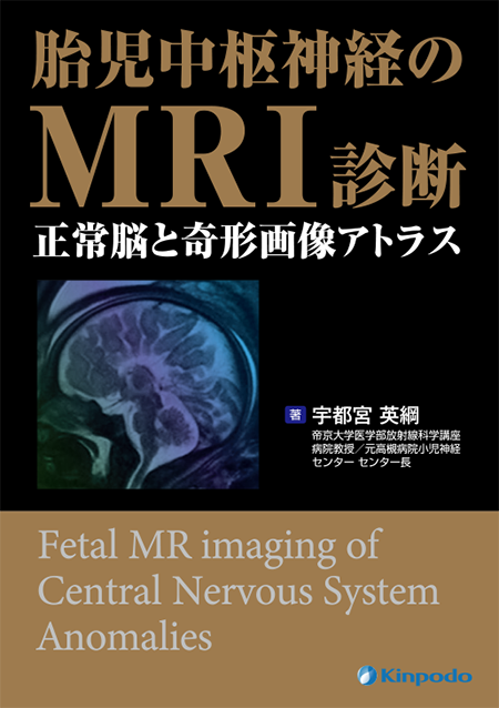 胎児中枢神経のMRI診断 正常脳と奇形画像アトラス
