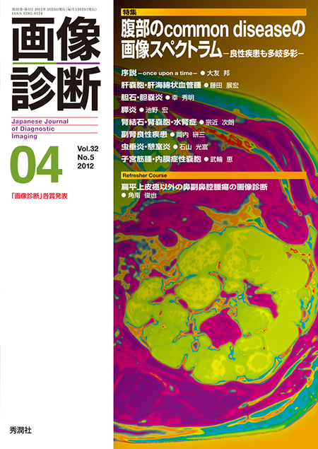 画像診断 2012年4月号（Vol.32 No.5） 腹部のcommon diseaseの画像スペクトラム -良性疾患も多岐多彩-