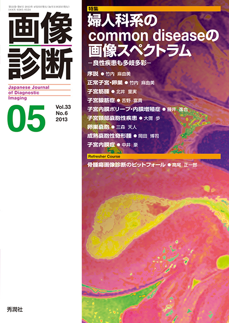画像診断 2013年5月号（Vol.33 No.6） 婦人科系のcommon diseaseの画像スペクトラム －良性疾患も多岐多彩