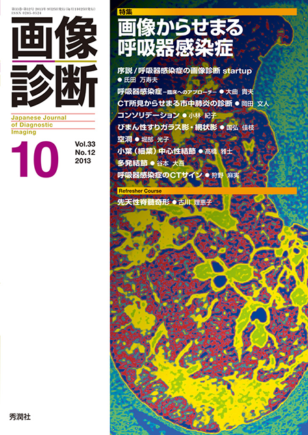 画像診断 2013年10月号（Vol.33 No.12） 画像からせまる呼吸器感染症