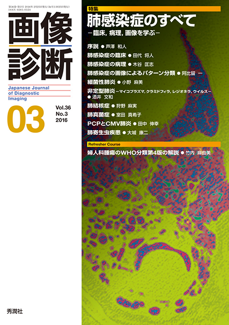 画像診断 2016年3月号（Vol.36 No.3） 肺感染症のすべて -臨床，病理，画像を学ぶ-
