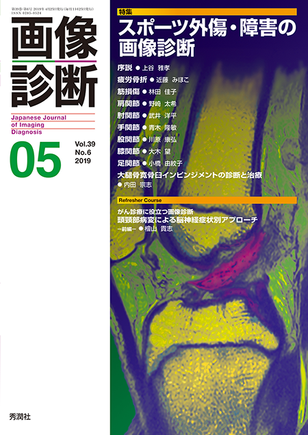 画像診断 2019年5月号（Vol.39 No.6）スポーツ外傷・障害の画像診断