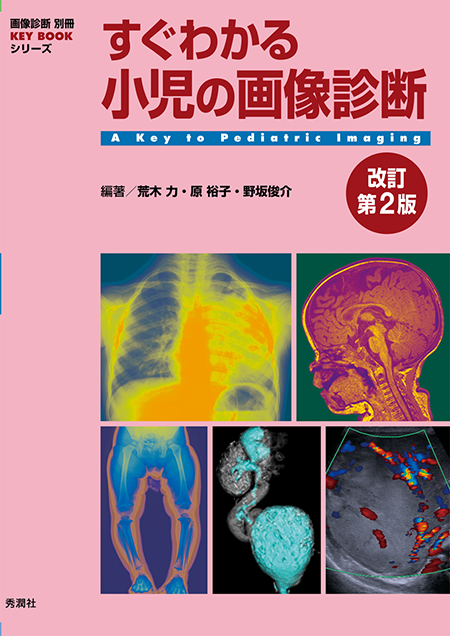 画像診断別冊 KEY BOOKシリーズ すぐわかる小児の画像診断 改訂第2版