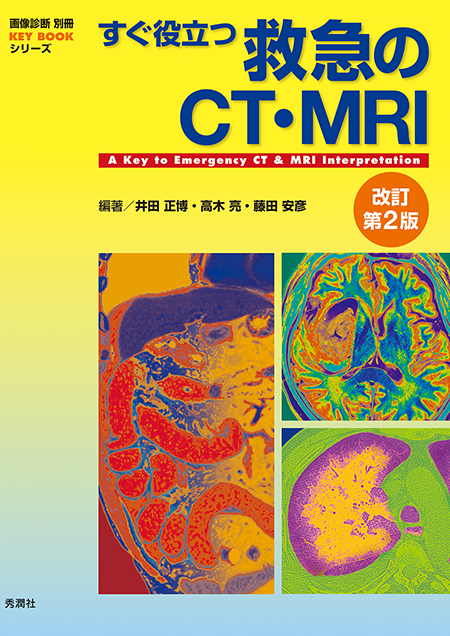 画像診断別冊 KEY BOOKシリーズ すぐ役立つ救急のCT・MRI 改訂第2版