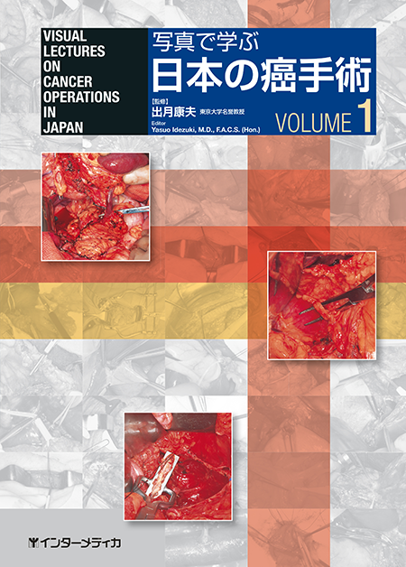 写真で学ぶ 日本の癌手術 Vol.1