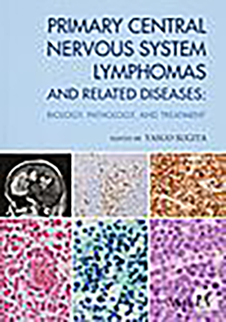 Primary Central Nervous System Lymphomas and Related Disease Biology, Pathology, and Treatment