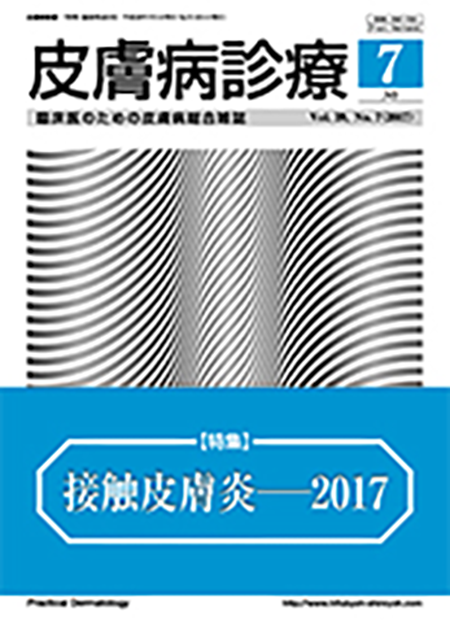 皮膚病診療Vol39, No.7（2017年7月号）